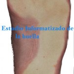 Huella digitalizdada con Escaner Digital Plantar