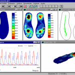 estudio gesto deportivo Biofoot