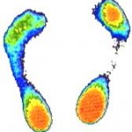 estudio presiones plantares sistema scangraf