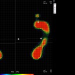 Freestep presiones plantares puntos